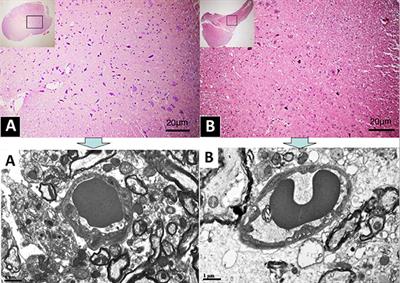 Ultrastructural Features of Neurovascular Units in a Rat Model of Chronic Compressive Spinal Cord Injury